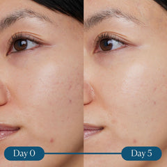 Facial Serum Elemis Dynamic Resurfacing 30 ml -  Beauty, Skin care -  Elemis.