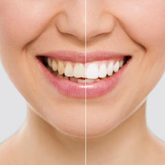 Teeth Whitening Strips Wripes InnovaGoods -  Health and personal care, Oral care -  InnovaGoods.